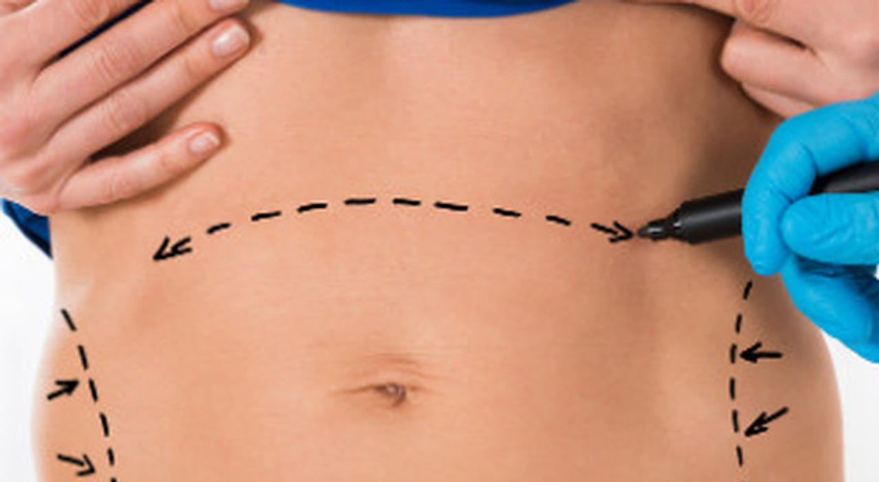 Как я победила диастаз и потратила 250 000 ₽ на свою новую жизнь